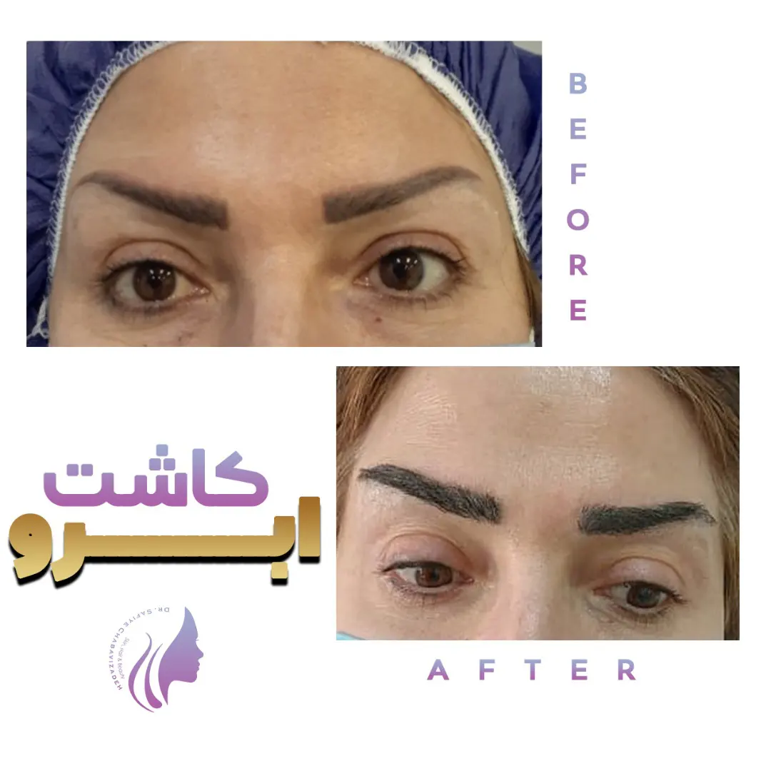 کلینیک تخصصی نوین اندولیفت