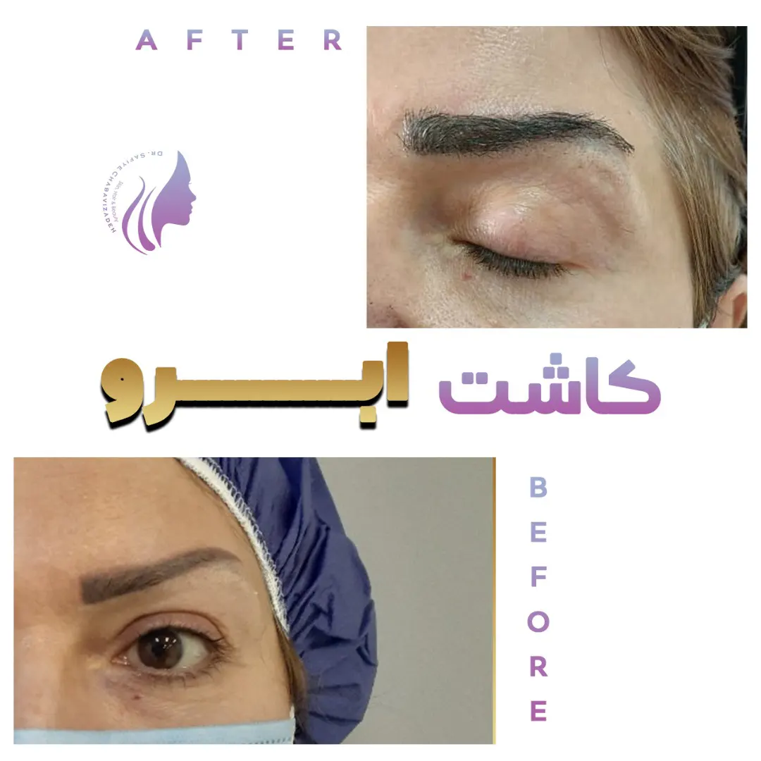 کلینیک تخصصی نوین اندولیفت